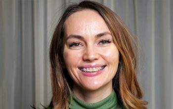 Why Are People Preferring Invisalign over Conventional Braces