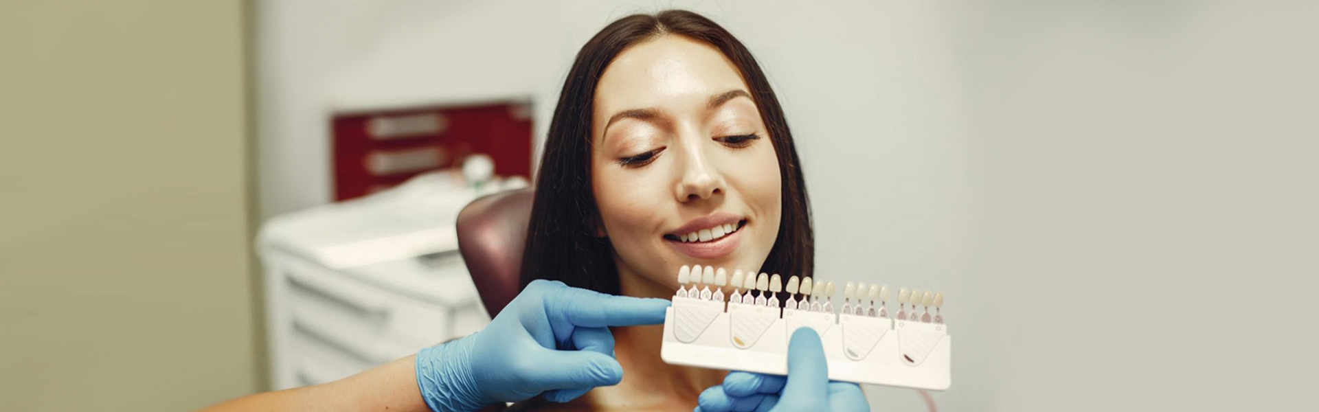 Top Benefits of Dental Veneers