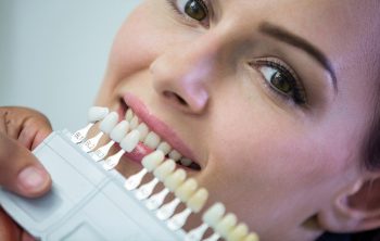 Dental Veneers: Everything You Need to Know Before Choosing Them